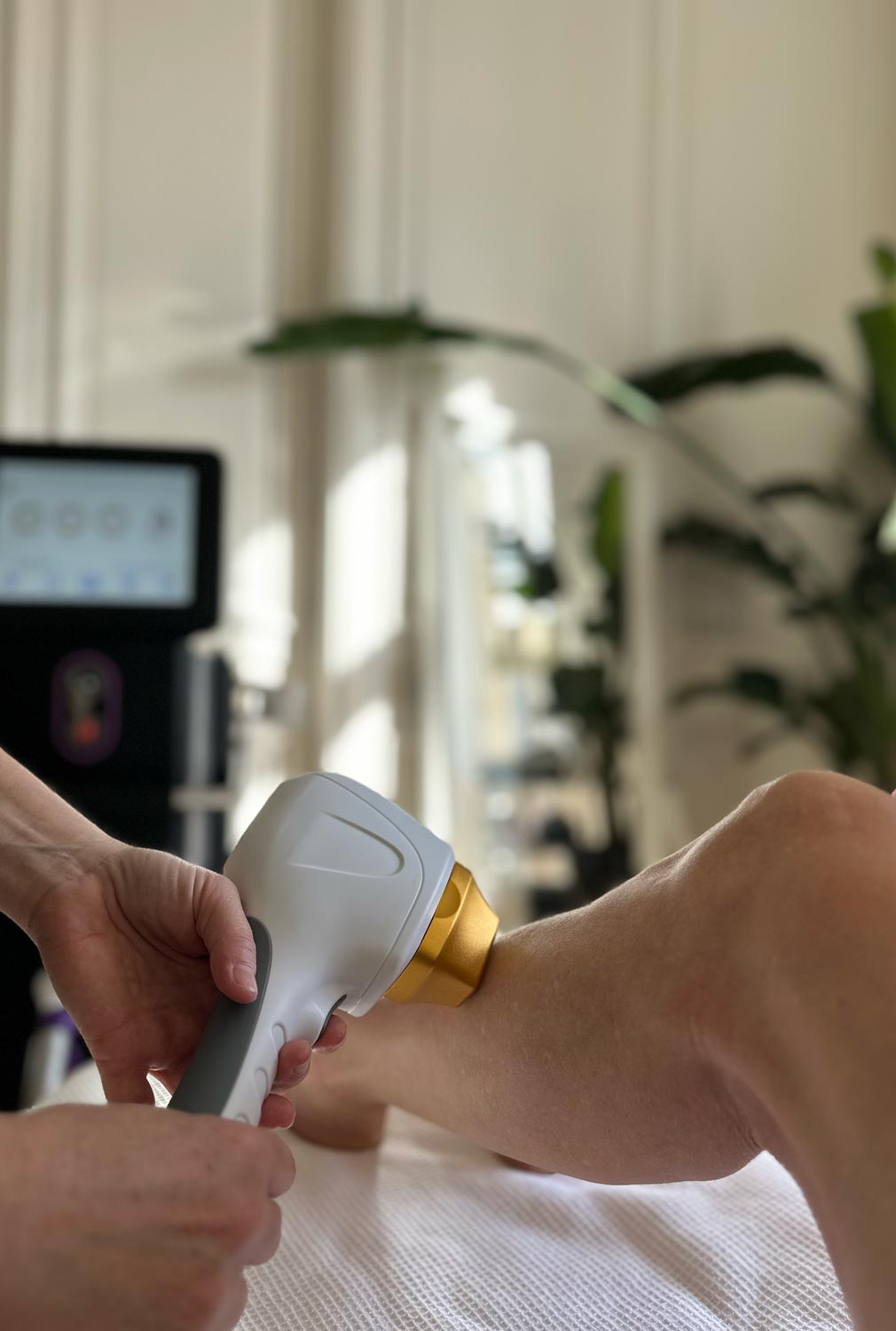 Epilation-laser Épilation laser