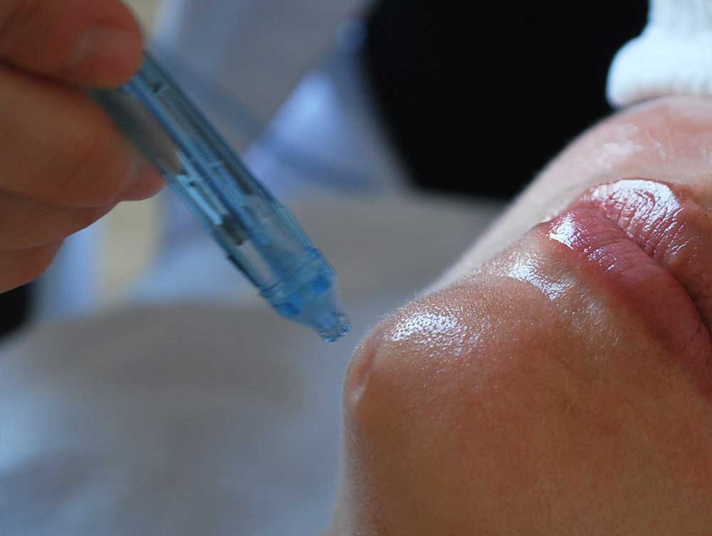 barophorese Barophorese