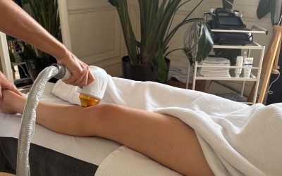 Épilation laser à Bordeaux : la solution durable pour une peau lisse et confortable